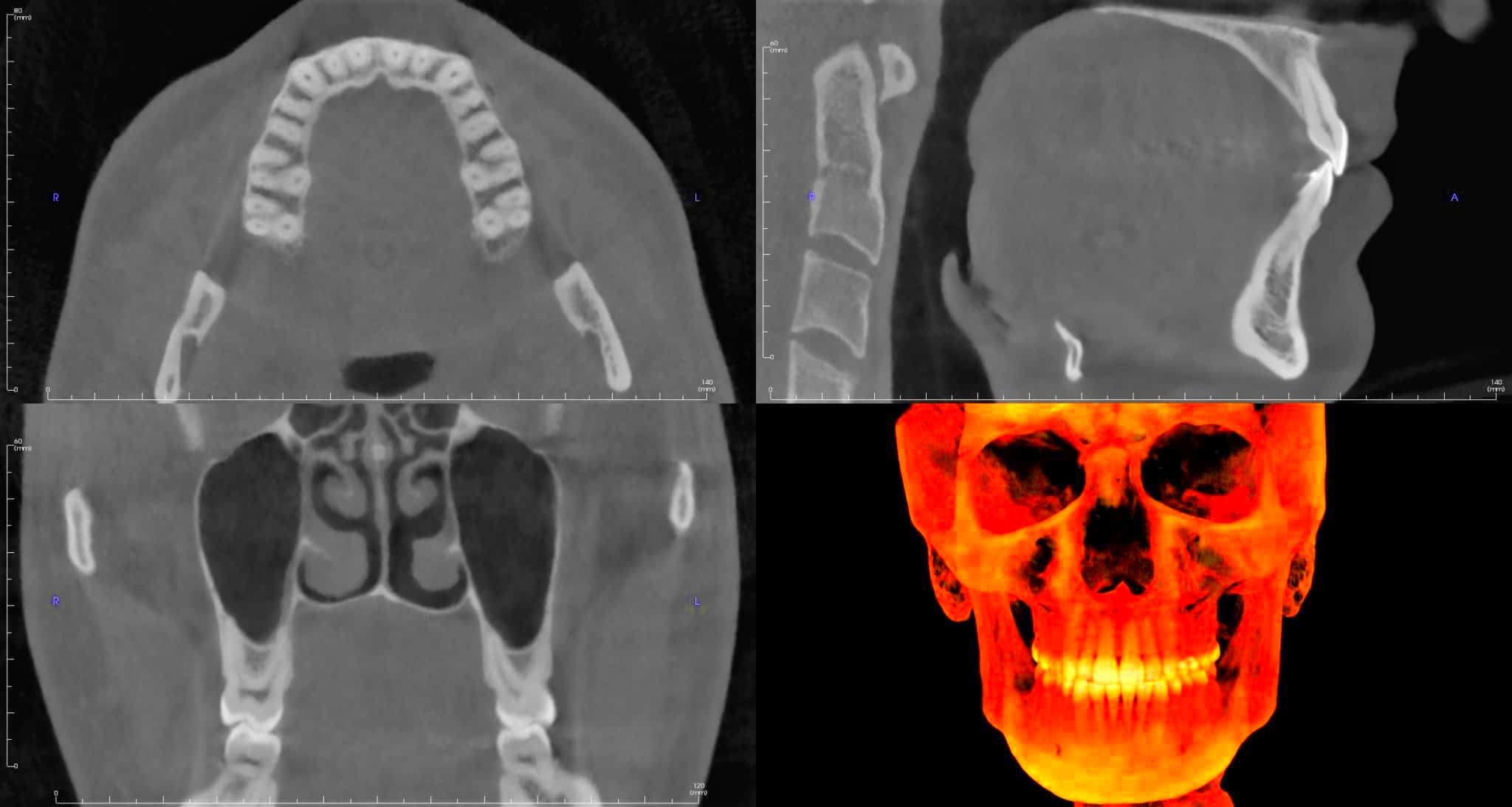 CBCT What is it and how does it work Radiodontics