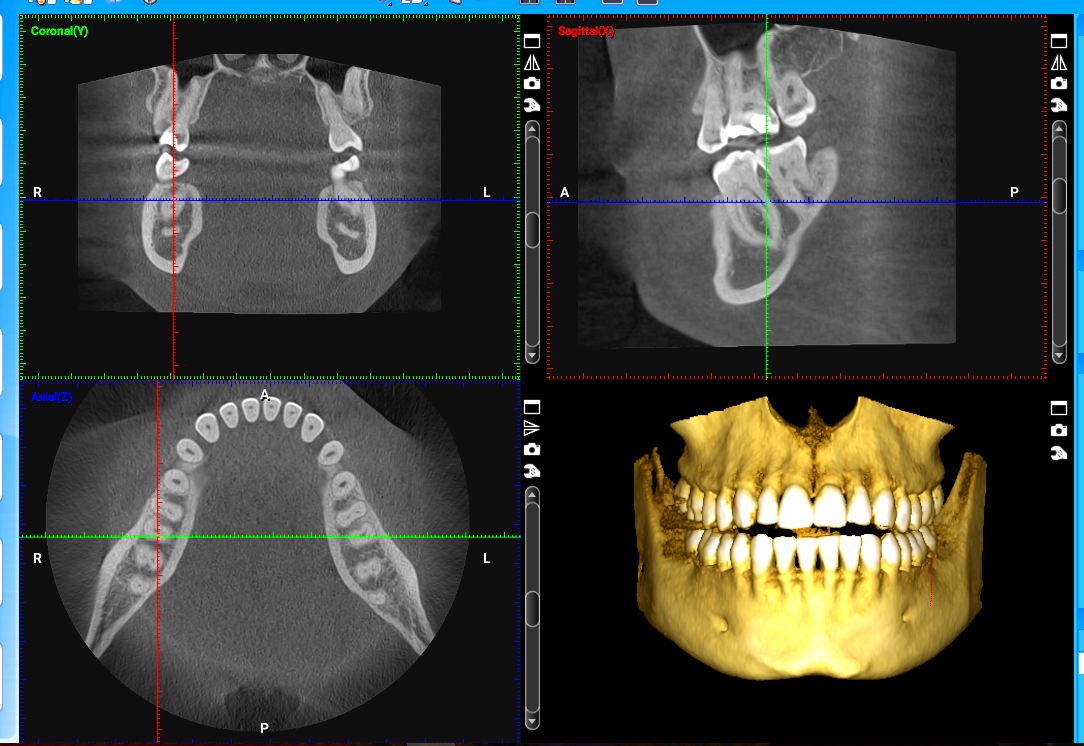 Cone Beam CT Scanner Buffalo Grove Illinois Drs Papworth and 