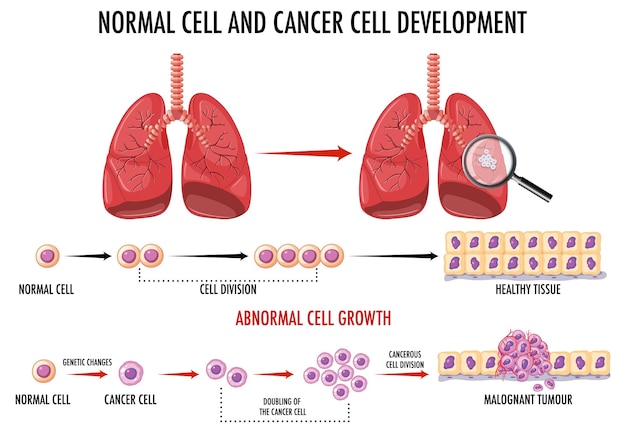 Diagram of Normal and Cancer Cells – Free Stock Photo, Download for Free