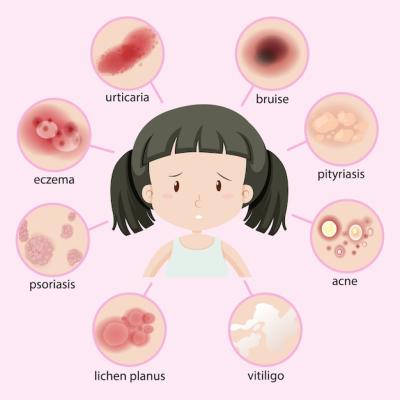 Types of Diseases in Kids – Free Download, Free Stock Photo