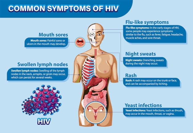 Common Symptoms of HIV – Free Download