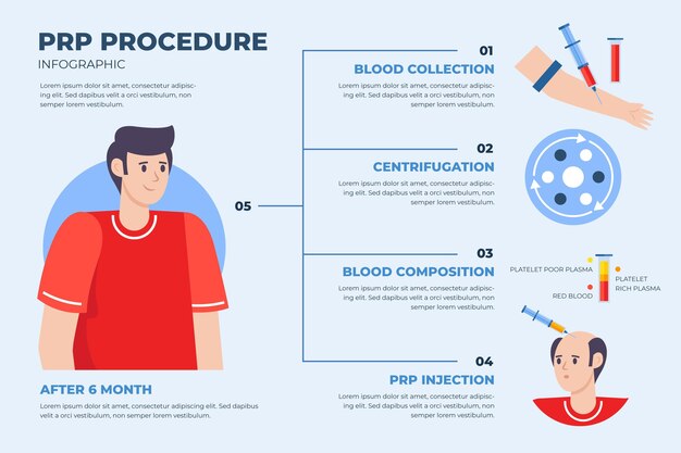 Flat Hand-Drawn PRP Procedure Infographic – Free Download