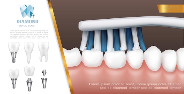 Realistic Dental Health Concept: Teeth Cleaning and Tooth Implants – Free Stock Photo for Download