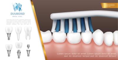 Realistic Dental Health Concept: Teeth Cleaning and Tooth Implants – Free Stock Photo for Download