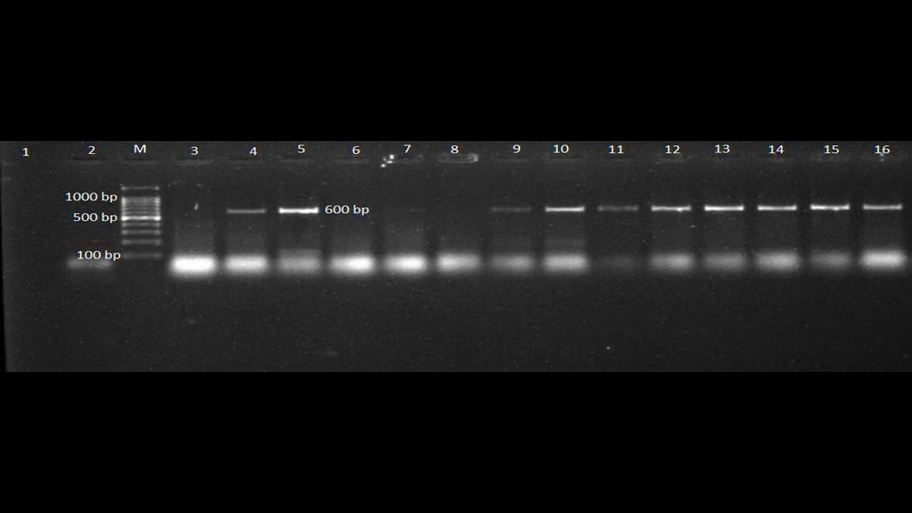 How to label Gel electrophoresis pictures for thesis and research 