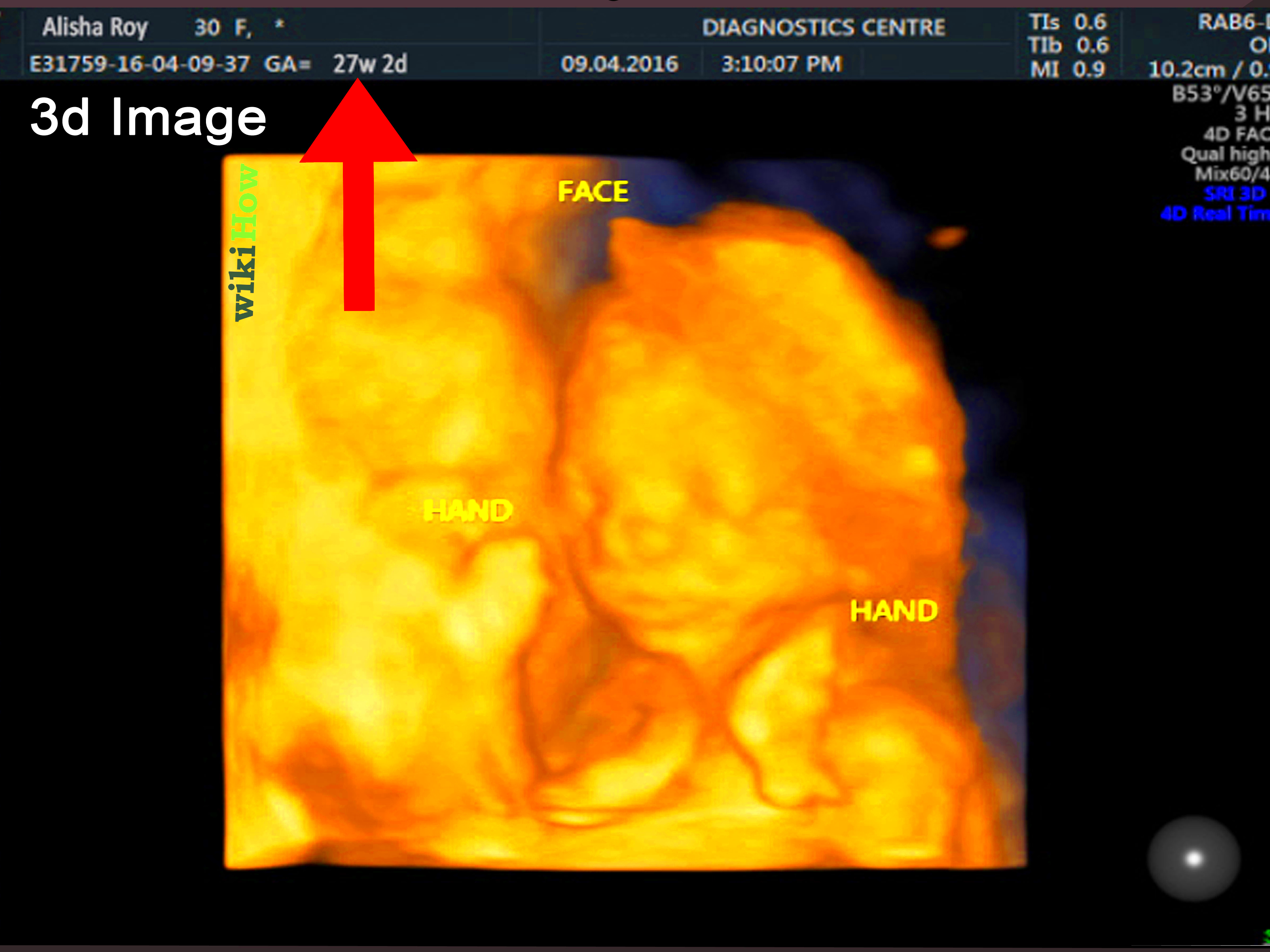 How to Read an Ultrasound Picture 8 Steps with Pictures