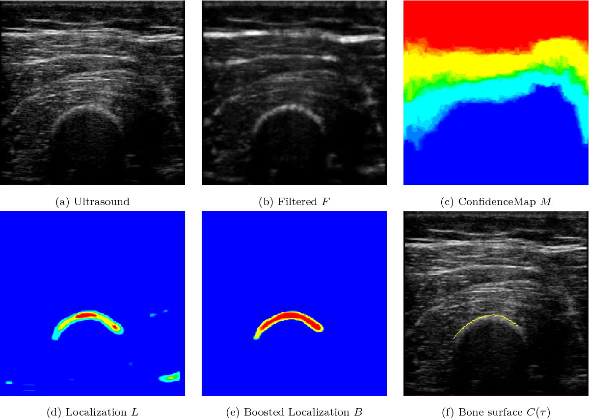 PDF Ultrasound confidence maps and applications in medical image 