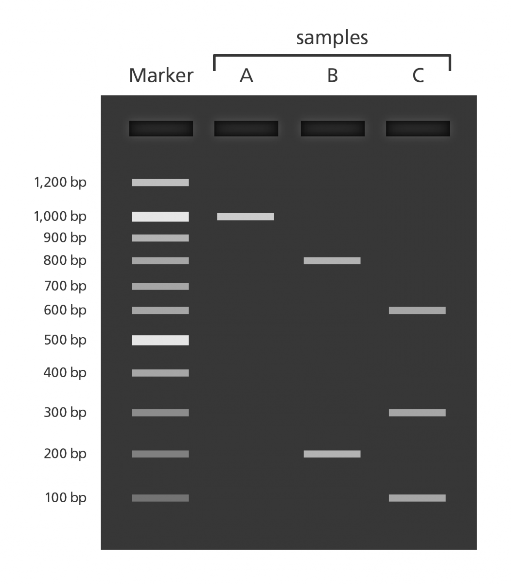 What does gel electrophoresis reveal about DNA  Socratic