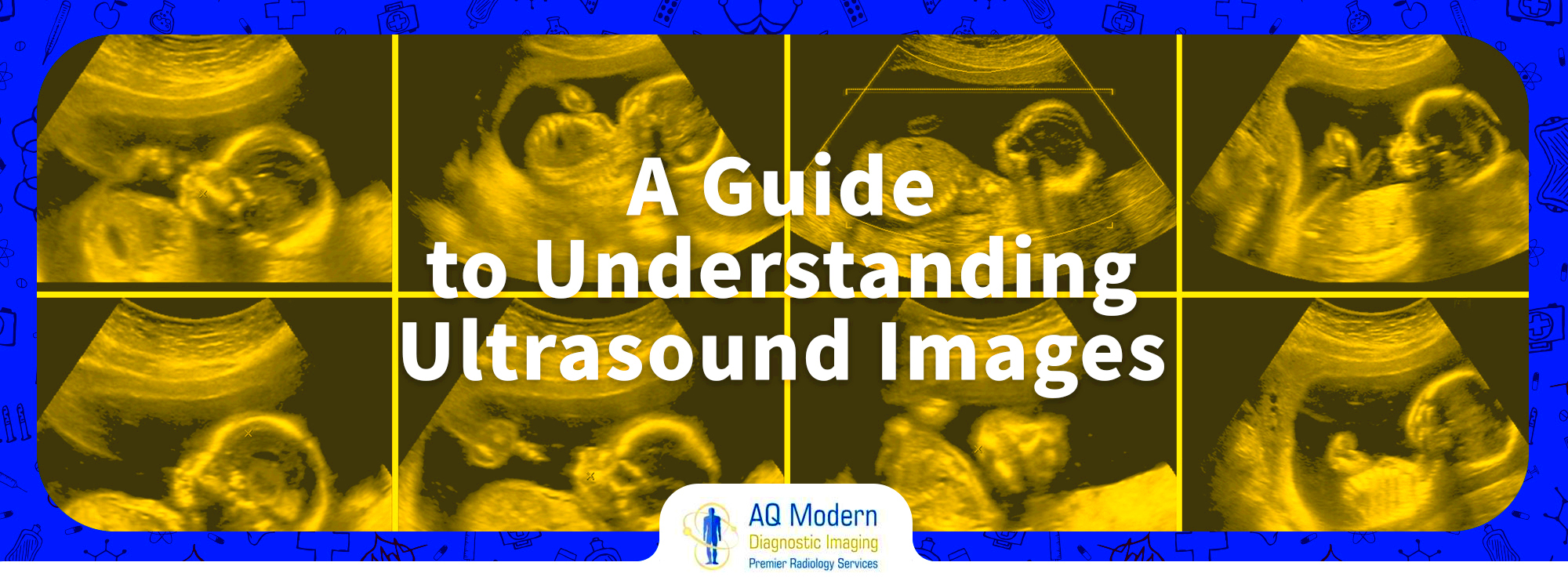 Ultrasound Images A Guide to Understanding Ultrasound Images