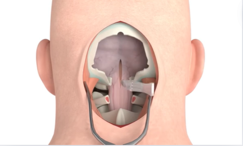 I Will Create High-Quality 3D Medical Animation Videos and 3D Product Animation Modeling