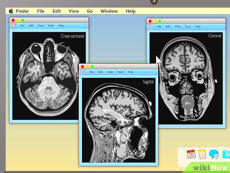 How to Read an MRI 15 Steps with Pictures  wikiHow