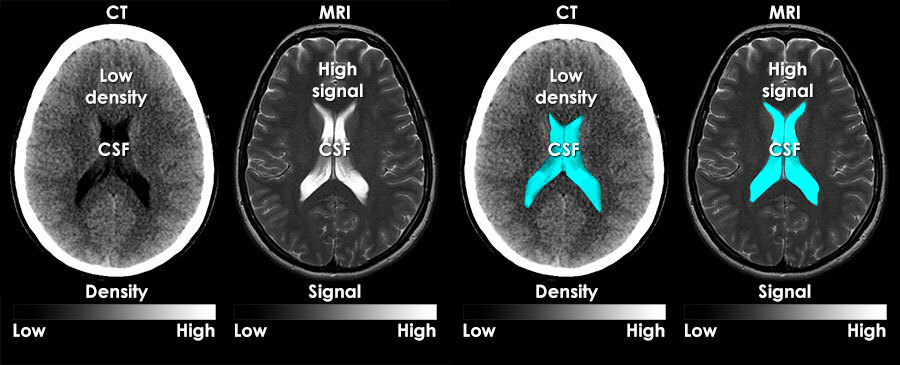 MRI interpretation  What are MRI images