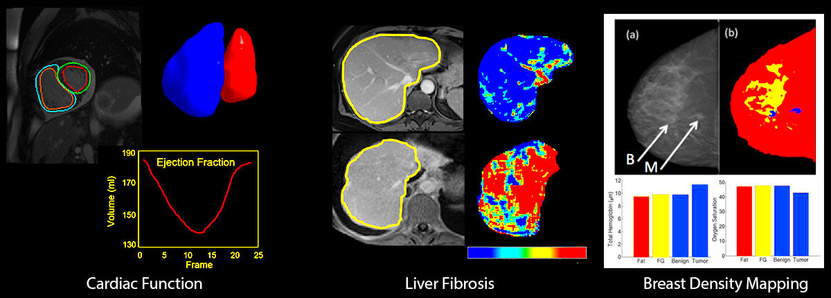 Image Processing  Medical Imaging