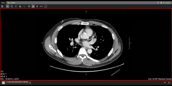 UCSF Patients Can Now Access Medical Images on MyChart  UCSF Radiology