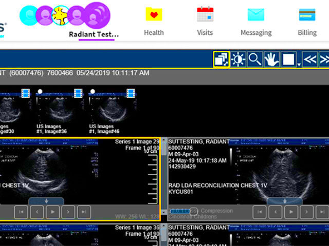 New Features in MyChart Relating to Radiology  Cincinnati Childrens Blog