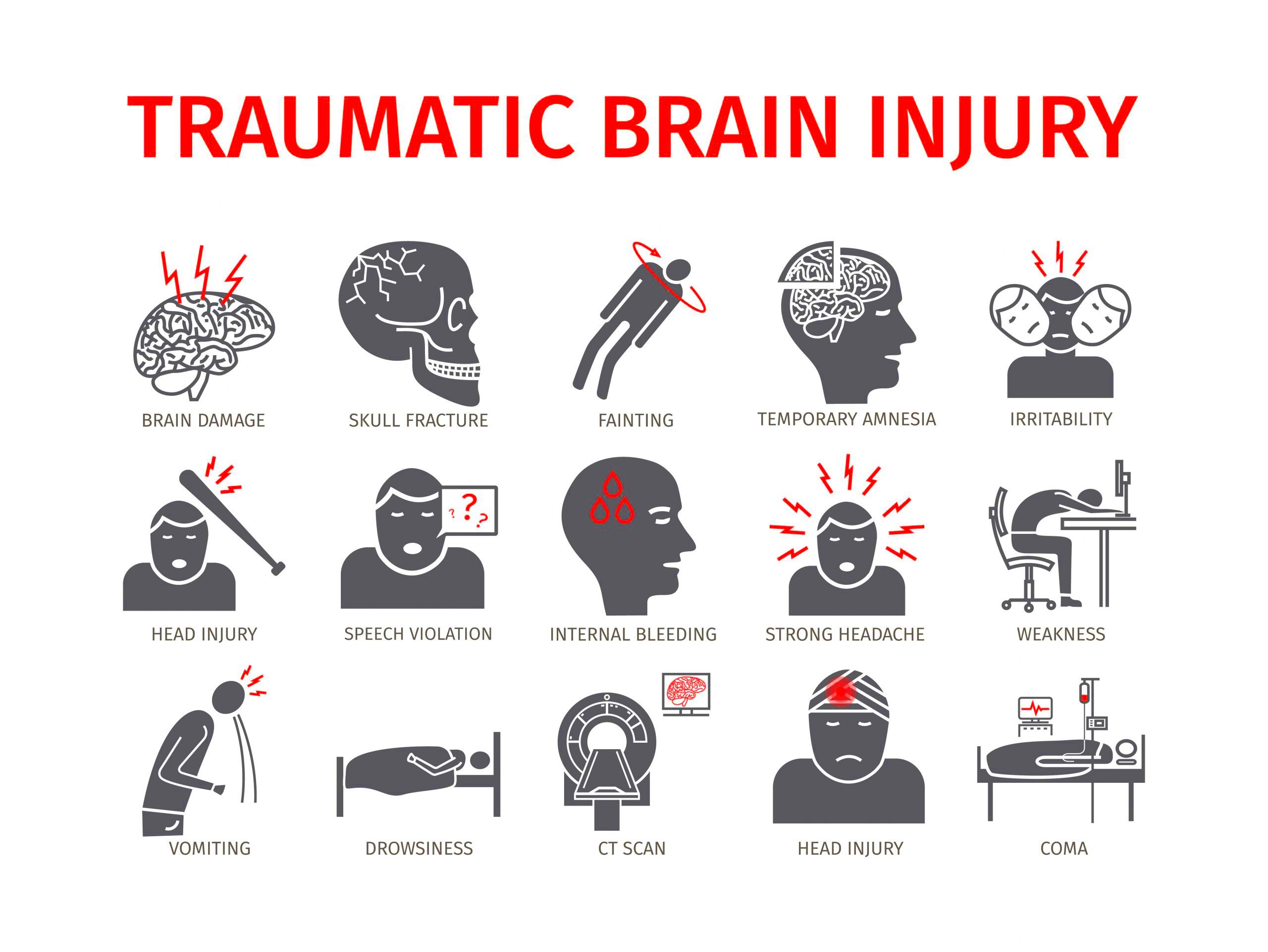 Types of Traumatic Brain Injuries TBIs  Sobo  Sobo