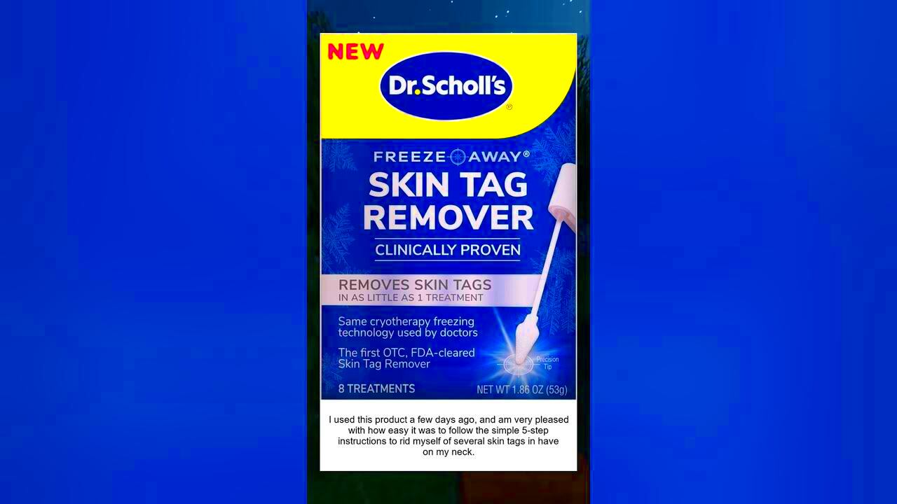 Dr Scholls Freeze Away Skin Tag Remover 8 Treatments  YouTube