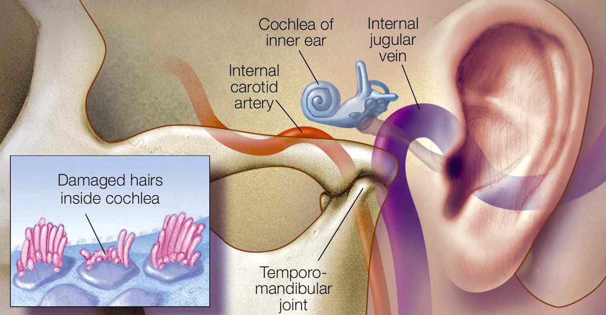 Tinnitus Professional Members  Toronto Tinnitus Clinic