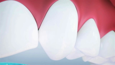 I will do 3D dental animation, tray whitening, dental models for oral health explainer