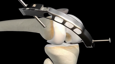 I will do 3D medical animation, surgery animation, surgical animation, 3D explainer video
