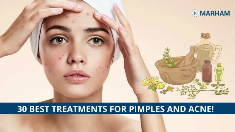 Clear Pimples in Just One Day with Natural Remedies