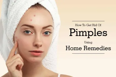 Clear Pimples in Just One Day with Natural Remedies