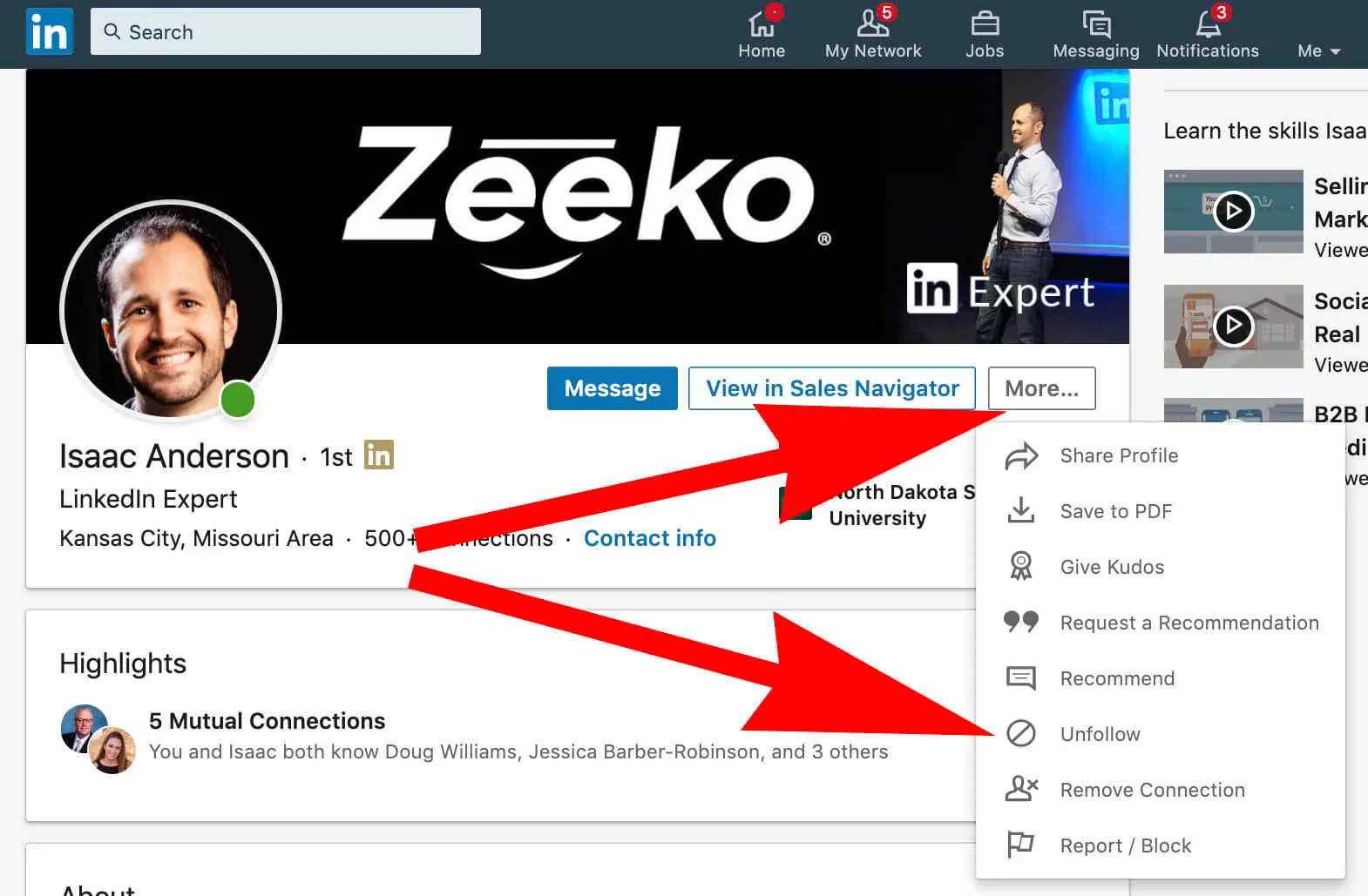 Mastering Your LinkedIn Feed by Unfollowing Connections