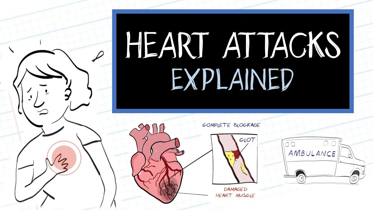 Understanding How Heart Attacks Occur with a Dailymotion Video Explanation