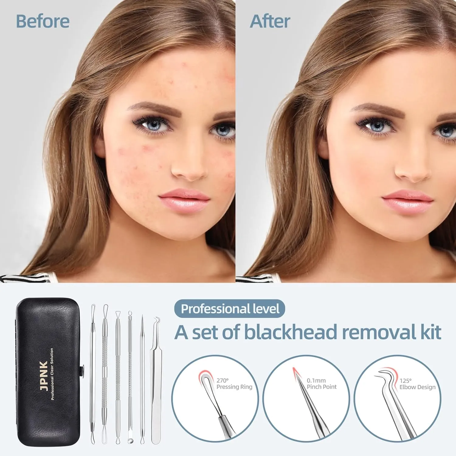 Blackhead Remover Tool  Achieve a Clear Face with the JPNK Blackhead 