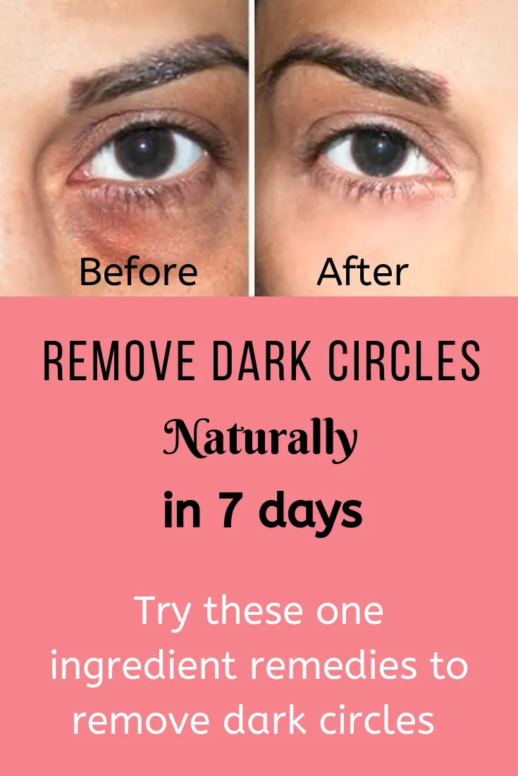 One ingredient remedies to remove dark circles naturally in 7 days Try 