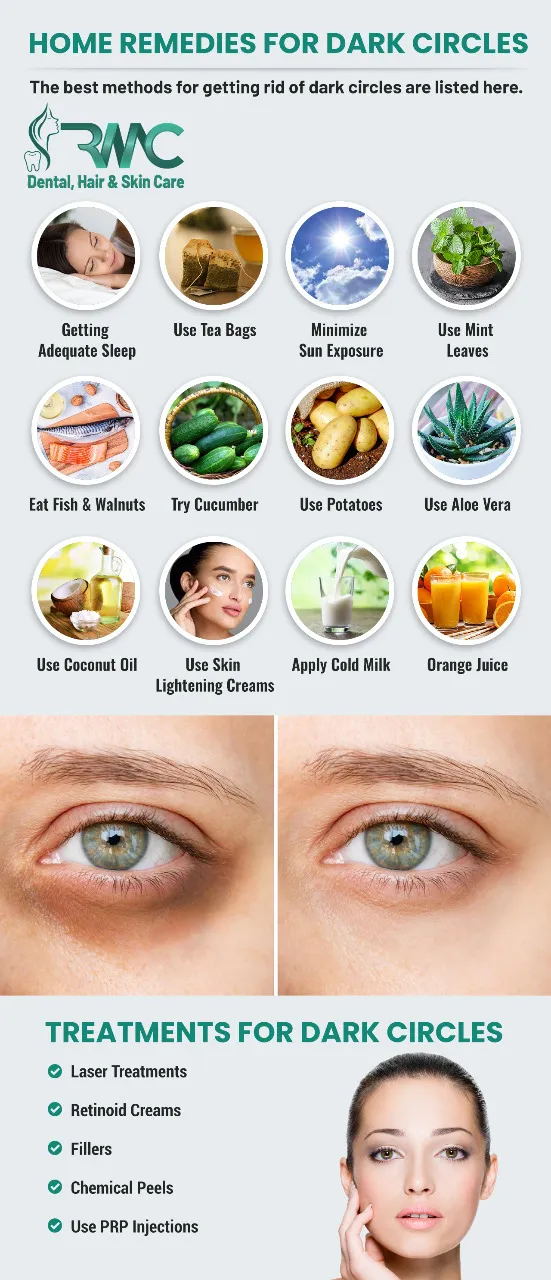 Effective Natural Tips for Removing Dark Circles