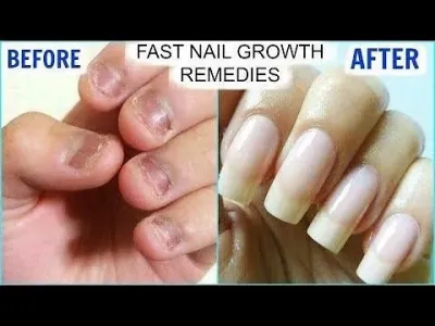 Grow Nails Faster in One Day with Proven Techniques