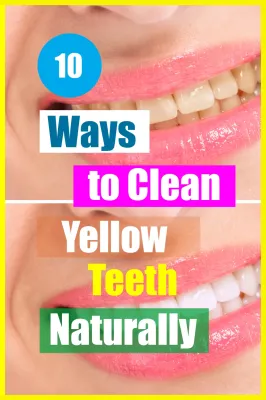 How to Clean Yellow Teeth at Home with Effective Tips and Techniques