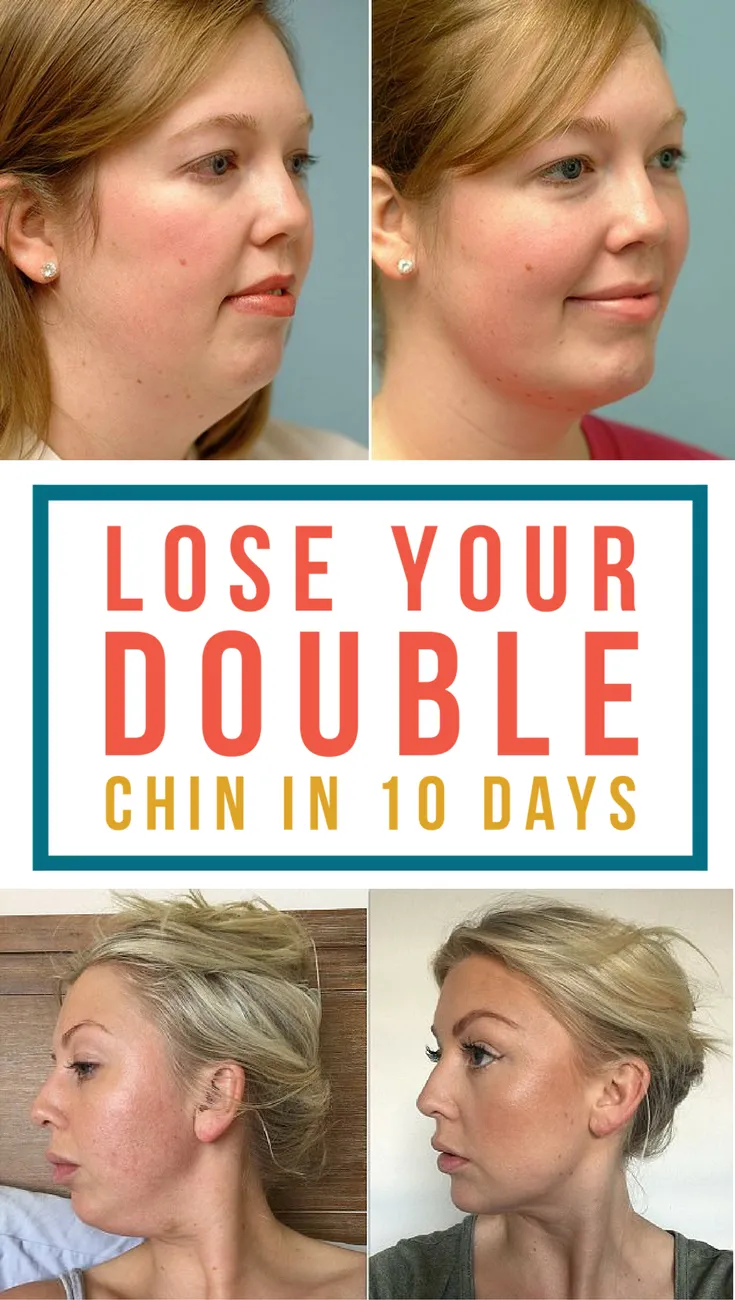 Home remedies and facial exercise to get rid of double chin wrap 