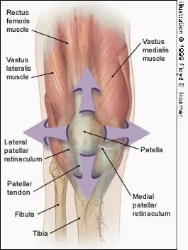 Patellofemoral syndrome  OSR Physical Therapy
