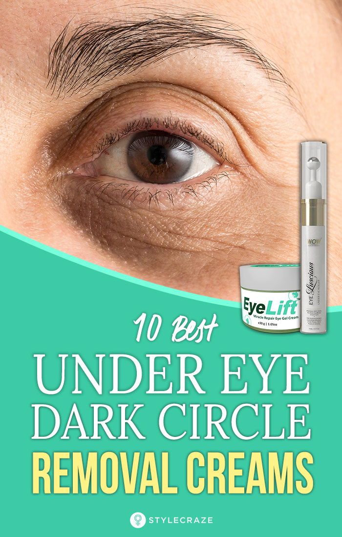 Simple Treatments to Reduce Dark Circles Under Eyes at Home