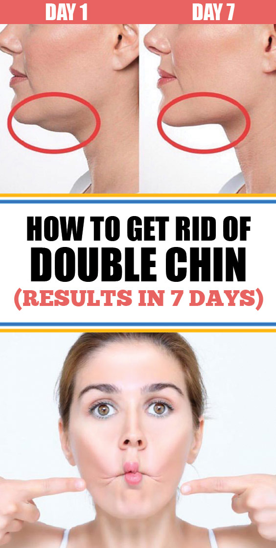 How To Get Rid Of Double Chin Results in 7 days  Healthy Food Remedy