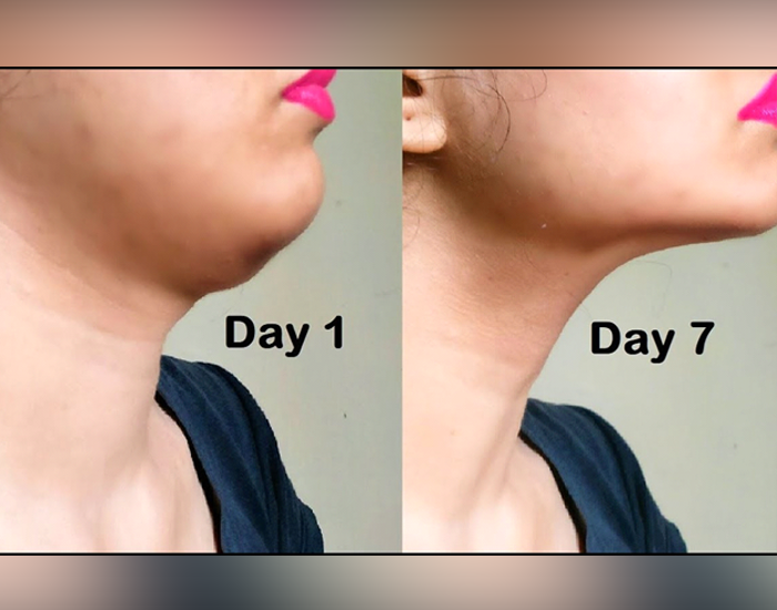 Get Rid Of Double Chin From Proven Exercises And Diet Tips  Reduce 