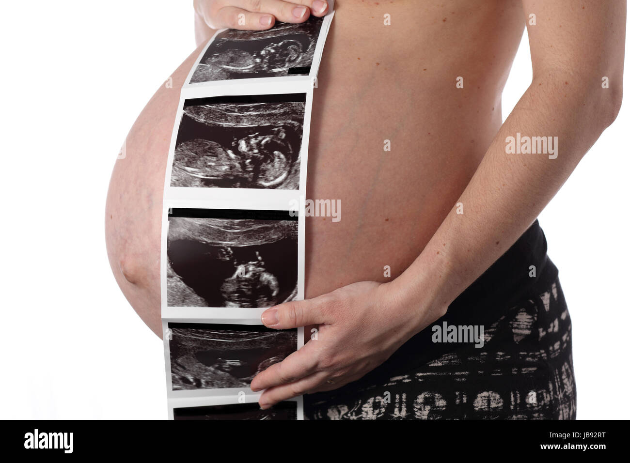 Understanding Pregnancy Symptoms of Belly Rumbles