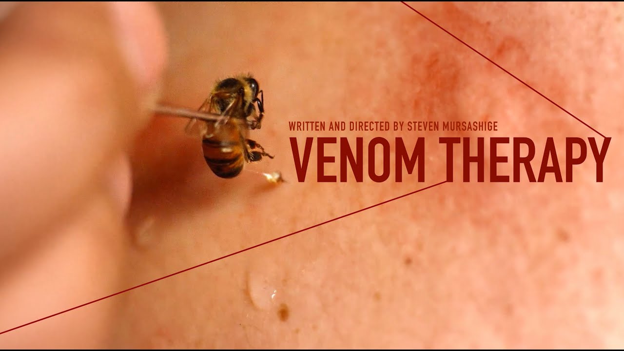 How to Use Bee Venom Patches on YouTube