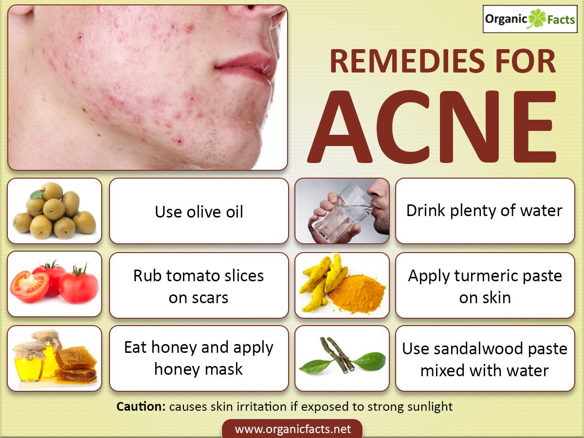 How to Clear Pimples in Just One Day with Natural Remedies