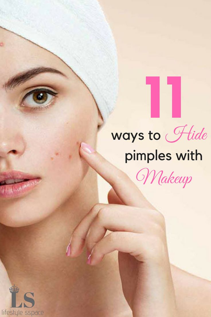 Effective Techniques to Hide Pimples with Makeup