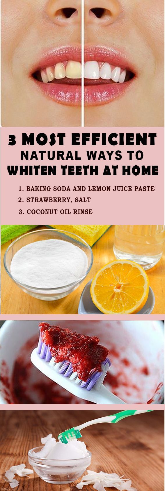 Pin on Natural Teeth Whitening