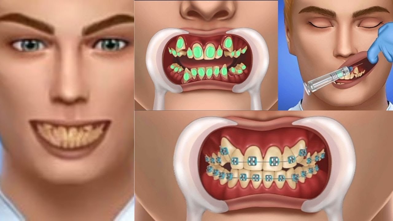 ASMR  Teeth Scaling  Dental Cleaning Treatment  Braces Animation 