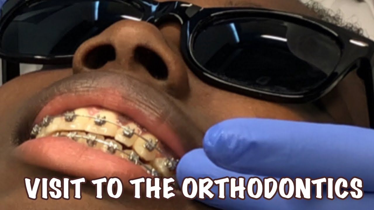 Braces Vlog orthodontics braces teeth  YouTube