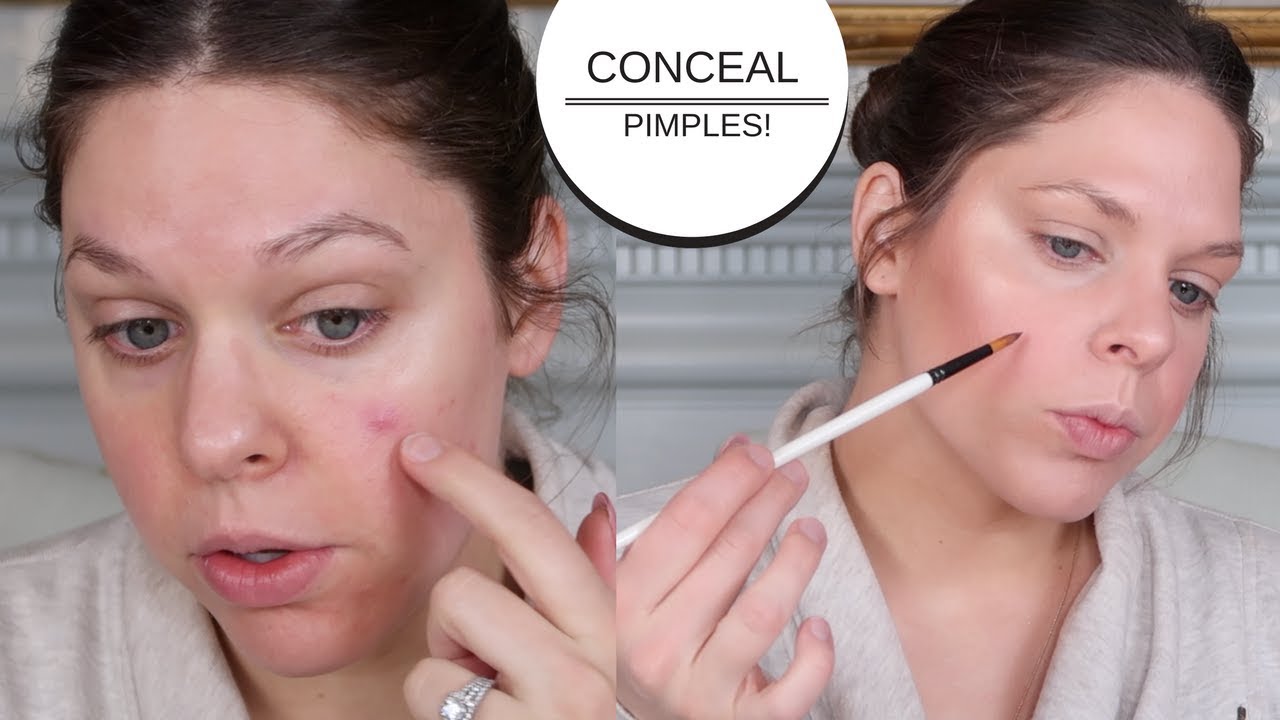 Mastering Makeup Techniques to Conceal Acne