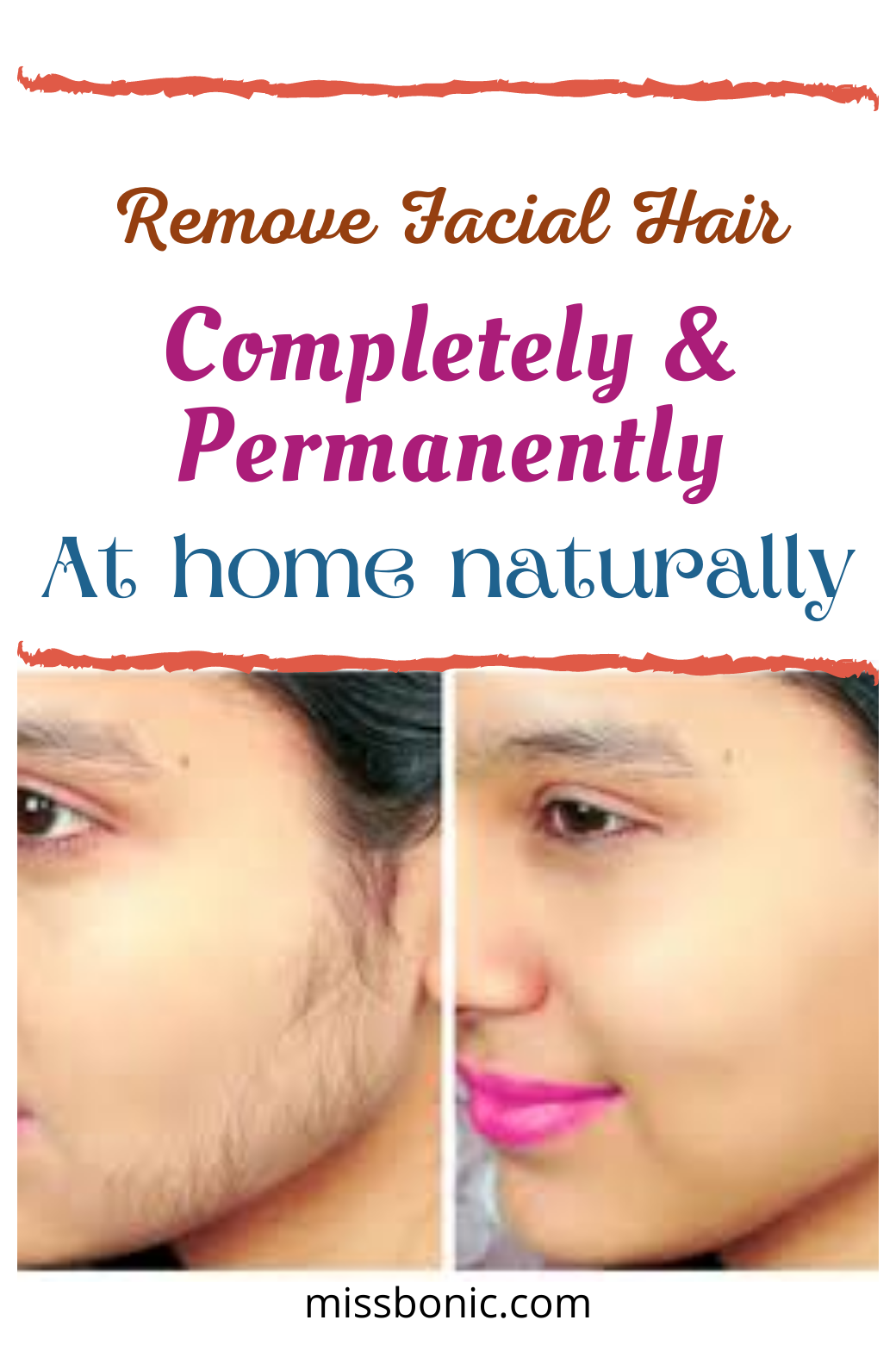 5 Natural Ways To Remove Facial Hair Permanently facial hair removal 