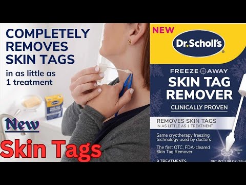 How to Use Dr. Scholl’s Skin Tag Remover