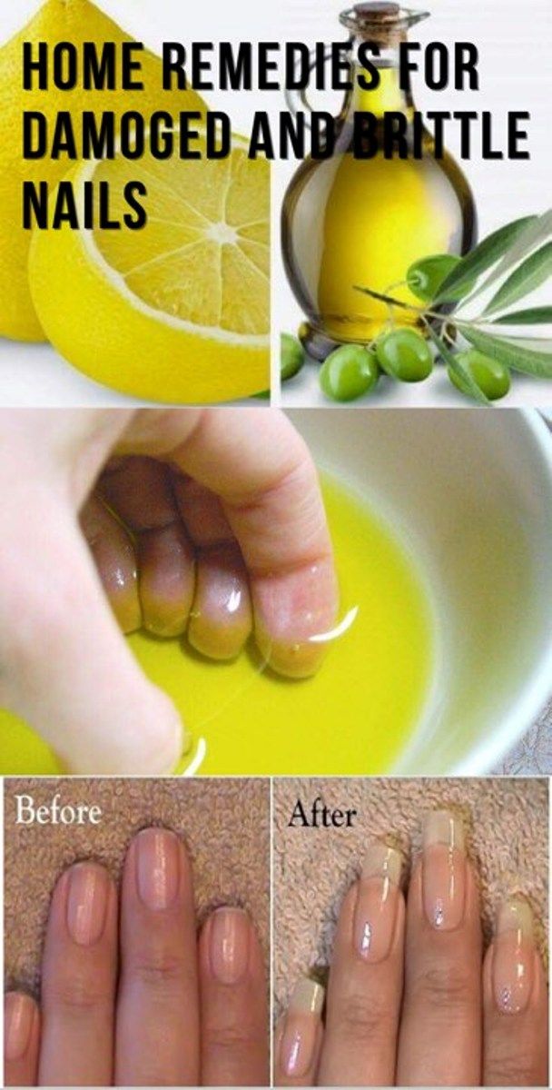 Home Remedies for Damaged and Brittle Nails 1  How to grow nails 