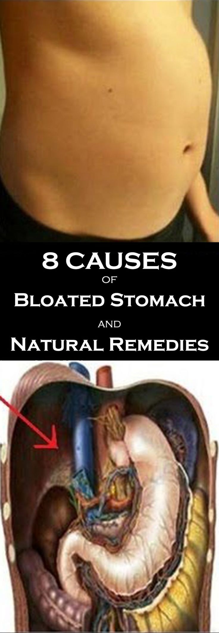 8 Causes Of Bloated Stomach and Natural Remedies  Bloated stomach 